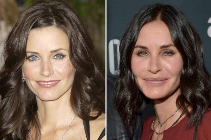 Before and After Courteney Cox